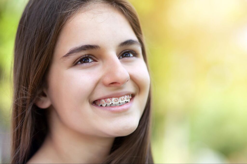How Does Orthodontics Fix Open Bites?