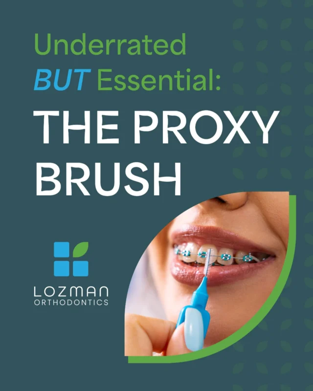 Let’s hear it for the most overlooked MVP in your braces toolkit: the proxy brush. 🙌 
 
This tiny brush is designed to slide between brackets and under wires, clearing out food and plaque your regular toothbrush can miss. It only takes a few seconds, but it can make a big difference for your smile by helping to prevent cavities, gum inflammation, and white spots around brackets. ✨
 
Not sure how to use it? Stop by our office for a quick demo or ask us at your next visit!